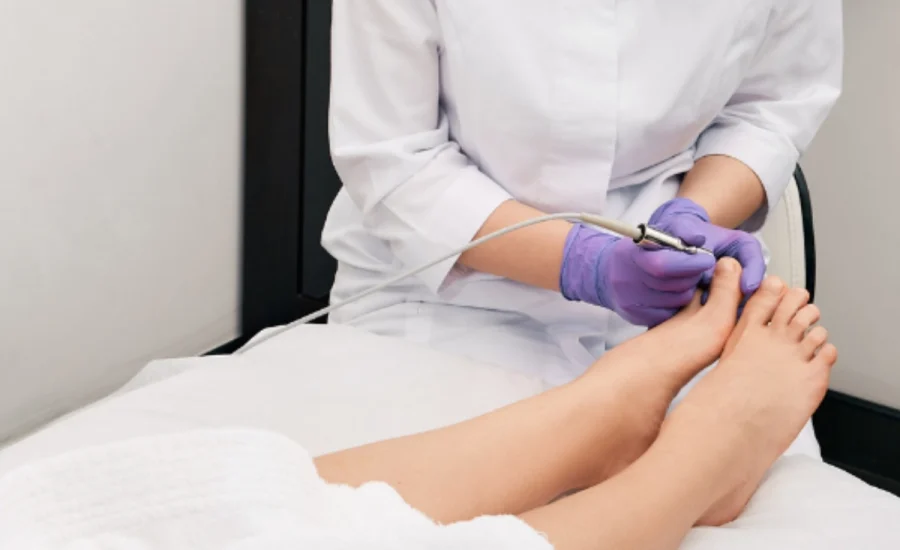 08.Dermatolog Dr. Muge Karaali Lazerle tirnak mantari tedavisi