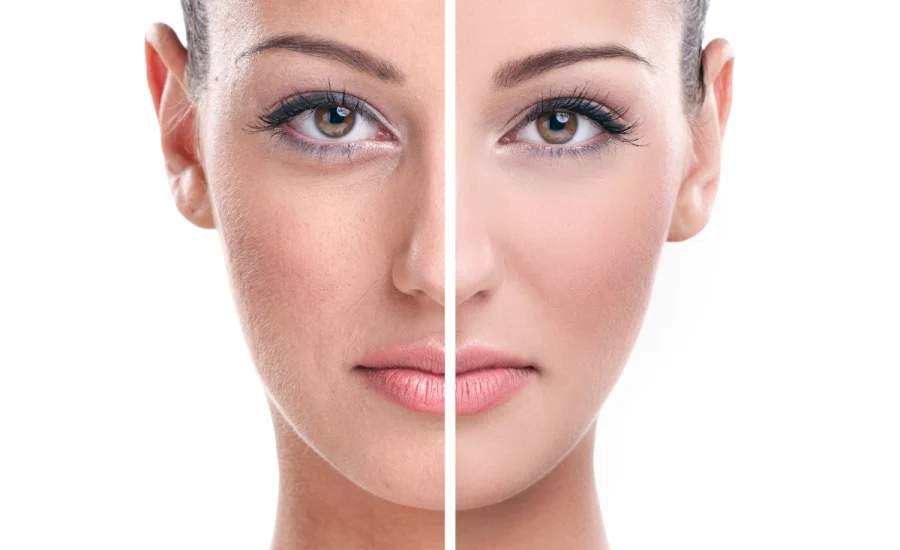 16.Dermatolog Dr. Muge Karaali Paris Isiltisi