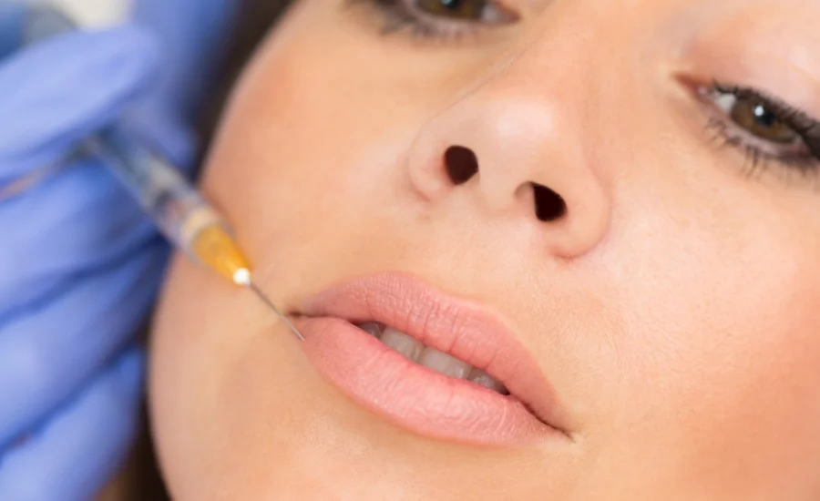 19.Dermatolog Dr. Muge Karaali Dudak Cevresi Genclestirme