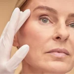 dr.-müge-göre-karaali-Leke-Kuruluk-İnce-Çizgilere-Karşı-Kışın-Uygulanabilecek-7-Klinik-Yöntem